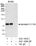 SPINDLY/CCDC99 Antibody in Immunoprecipitation (IP)