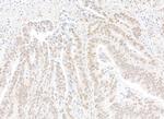 CPSF68 Antibody in Immunohistochemistry (Paraffin) (IHC (P))