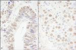 CPSF68 Antibody in Immunohistochemistry (Paraffin) (IHC (P))