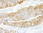 CAD Antibody in Immunohistochemistry (Paraffin) (IHC (P))