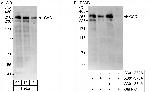 CAD Antibody in Western Blot (WB)