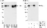 CAD Antibody in Western Blot (WB)