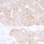 CAD Antibody in Immunohistochemistry (Paraffin) (IHC (P))