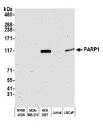 PARP1 Antibody in Western Blot (WB)