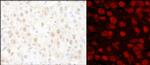 PARP1 Antibody in Immunohistochemistry (Paraffin) (IHC (P))