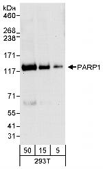 PARP1 Antibody in Western Blot (WB)