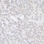 BRCA1 Antibody in Immunohistochemistry (Paraffin) (IHC (P))