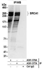 BRCA1 Antibody in Immunoprecipitation (IP)