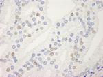 UACA Antibody in Immunohistochemistry (Paraffin) (IHC (P))