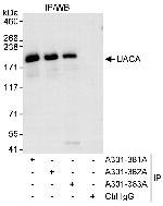 UACA Antibody in Immunoprecipitation (IP)