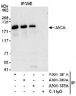 UACA Antibody in Immunoprecipitation (IP)