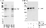 UACA Antibody in Western Blot (WB)