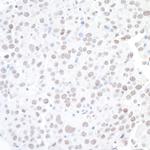 BAF53A Antibody in Immunohistochemistry (Paraffin) (IHC (P))