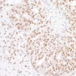 BAF53A Antibody in Immunohistochemistry (Paraffin) (IHC (P))