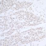 CTR9 Antibody in Immunohistochemistry (Paraffin) (IHC (P))