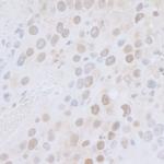 CTR9 Antibody in Immunohistochemistry (Paraffin) (IHC (P))