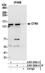 CTR9 Antibody in Immunoprecipitation (IP)