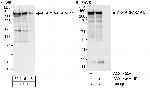 AKAP13/AKAP-Lbc Antibody in Western Blot (WB)