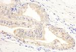 KANK2/SIP Antibody in Immunohistochemistry (Paraffin) (IHC (P))