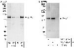 ZHX3 Antibody in Western Blot (WB)