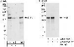 ZHX3 Antibody in Western Blot (WB)