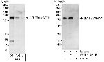 CENTD2/ARAP1 Antibody in Western Blot (WB)