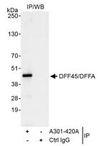 DFF45/DFFA Antibody in Immunoprecipitation (IP)