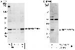 DFF35/DFFA Antibody in Western Blot (WB)