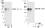 EPB41L2/4.1G Antibody in Western Blot (WB)