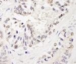 FOG1/ZFPM1 Antibody in Immunohistochemistry (Paraffin) (IHC (P))