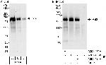 IRS2 Antibody in Western Blot (WB)