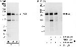 IRS2 Antibody in Western Blot (WB)