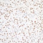 WTAP Antibody in Immunohistochemistry (Paraffin) (IHC (P))