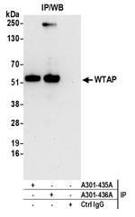 WTAP Antibody in Immunoprecipitation (IP)