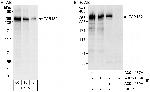 TAB182 Antibody in Western Blot (WB)