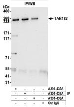 TAB182 Antibody in Immunoprecipitation (IP)