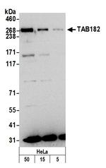 TAB182 Antibody in Western Blot (WB)