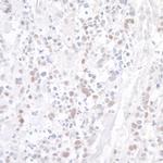 WDR79 Antibody in Immunohistochemistry (Paraffin) (IHC (P))