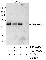 KIAA0528 Antibody in Immunoprecipitation (IP)