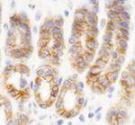 KIAA0528 Antibody in Immunohistochemistry (Paraffin) (IHC (P))