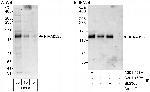 KIAA0528 Antibody in Western Blot (WB)