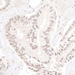 NP95/UHRF1 Antibody in Immunohistochemistry (Paraffin) (IHC (P))