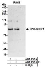 NP95/UHRF1 Antibody in Immunoprecipitation (IP)