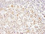 Caf1p150 Antibody in Immunohistochemistry (Paraffin) (IHC (P))