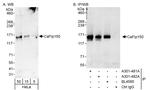 Caf1p150 Antibody in Western Blot (WB)