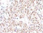 Caf1p150 Antibody in Immunohistochemistry (Paraffin) (IHC (P))