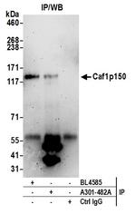 Caf1p150 Antibody in Immunoprecipitation (IP)