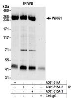 WNK1 Antibody in Immunoprecipitation (IP)