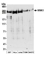 WNK1 Antibody in Western Blot (WB)