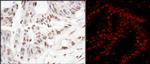 SART3/TIP110 Antibody in Immunohistochemistry (Paraffin) (IHC (P))